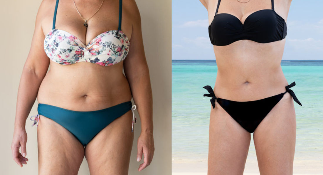 Does Weight Loss Become More Difficult With Age?
