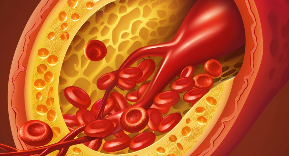 The truth about statins